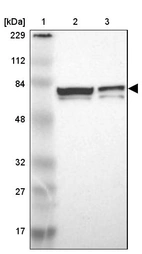 Lane 1: Marker [kDa] 229, 112, 84, 48, 32, 27, 17_br/_Lane 2: Human cell line RT-4_br/_Lane 3: Human cell line U-251MG sp