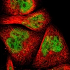 Immunofluorescent staining of human cell line A-431 shows localization to nucleoplasm.