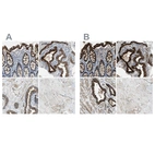 Immunohistochemical staining of human colon, placenta, prostate and skeletal muscle using Anti-FLNB antibody HPA004886 (A) shows similar protein distribution across tissues to independent antibody HPA004747 (B).