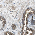 Immunohistochemical staining of human prostate shows strong membranous positivity in glandular cells.