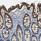 Immunohistochemical staining of human colon shows strong membranous positivity in glandular cells.