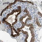 Immunohistochemical staining of human placenta shows strong membranous positivity in trophoblastic cells.