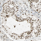 Anti-SUGP1 Antibody