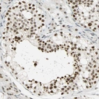 Immunohistochemical staining of human Testis shows strong nuclear positivity in cells in seminiferous ducts and leydig cells.