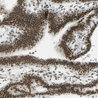 Anti-SUGP1 Antibody