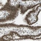 Immunohistochemical staining of human Fallopian tube shows strong nuclear positivity in glandular cells.