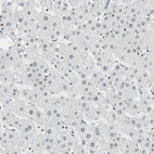 Immunohistochemical staining of human Liver shows very weak nuclear positivity in hepatocytes.