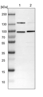 Lane 1: NIH-3T3 cell lysate (Mouse embryonic fibroblast cells)_br/_Lane 2: NBT-II cell lysate (Rat Wistar bladder tumour cells)