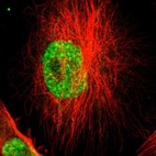 Immunofluorescent staining of human cell line U-251 MG shows localization to nucleoplasm.