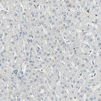Immunohistochemical staining of human liver shows no positivity in hepatocytes.