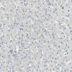 Anti-CCNT1 Antibody