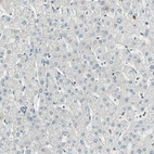 Immunohistochemical staining of human liver shows no positivity in hepatocytes.