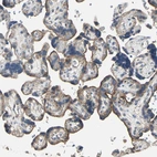 Immunohistochemical staining of human placenta shows moderate cytoplasmic positivity in trophoblastic cells