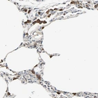 Immunohistochemical staining of human lung shows moderate cytoplasmic positivity in macrophages.