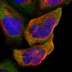 Immunofluorescent staining of human cell line A-431 shows localization to cytosol.