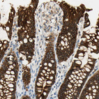 Immunohistochemical staining of human rectum shows strong membranous positivity in glandular cells.