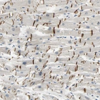 Immunohistochemical staining of human heart muscle shows moderate positivity in intercalated discs.