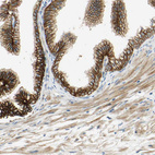 Anti-DSG2 Antibody