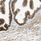 Immunohistochemical staining of human prostate shows moderate to strong membranous positivity in glandular cells.