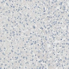 Immunohistochemical staining of human liver shows no positivity in hepatocytes as expected.