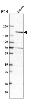 Western blot analysis in human cell line BEWO.