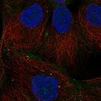 Immunofluorescent staining of human cell line A-431 shows localization to plasma membrane, cell junctions & vesicles.