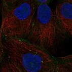 Immunofluorescent staining of human cell line A-431 shows localization to plasma membrane, cell junctions & vesicles.