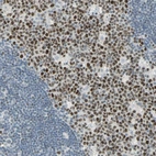 Immunohistochemical staining of human lymph node shows strong nuclear positivity in germinal center cells.