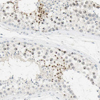 Anti-BCL6 Antibody