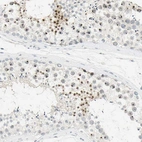 Immunohistochemical staining of human testis shows moderate to strong nuclear positivity in cells in seminiferous ducts.