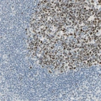 Immunohistochemical staining of human tonsil shows strong nuclear positivity in germinal center cells.