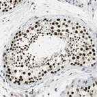Immunohistochemical staining of human testis shows strong nuclear positivity in cells in seminiferous ducts.