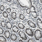 Immunohistochemical staining of human duodenum shows strong nuclear positivity in glandular cells.