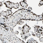 Immunohistochemical staining of human placenta shows strong nuclear positivity in trophoblastic cells.