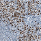 Immunohistochemical staining of human spleen shows moderate to strong cytoplasmic positivity in cells in red pulp.