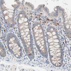 Anti-CLEC4D Antibody