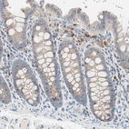 Immunohistochemical staining of human colon shows moderate to strong cytoplasmic positivity in lymphoid cells.