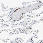 Immunohistochemical staining of human lung shows moderate to strong cytoplasmic positivity in leukocytes.