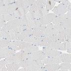 Immunohistochemical staining of human skeletal muscle shows no positivity in myocytes as expected.