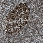 Anti-HNRNPD Antibody