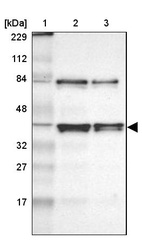 Lane 1: Marker [kDa] 229, 112, 84, 48, 32, 27, 17_br/_Lane 2: Human cell line RT-4_br/_Lane 3: Human cell line U-251MG sp