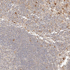 Anti-PTPN22 Antibody
