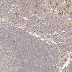 Anti-PTPN22 Antibody