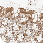 Immunohistochemical staining of human Colon shows moderate cytoplasmic positivity in glandular cells.