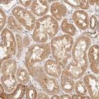 Immunohistochemical staining of human Kidney shows moderate cytoplasmic positivity in cells in tubules.