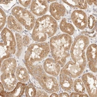Immunohistochemical staining of human Kidney shows moderate cytoplasmic positivity in cells in tubules.