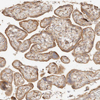 Immunohistochemical staining of human Placenta shows moderate cytoplasmic and membranous positivity in trophoblastic cells.