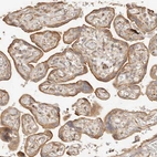 Immunohistochemical staining of human Placenta shows moderate cytoplasmic and membranous positivity in trophoblastic cells.