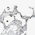 Immunohistochemical staining of human lung shows strong cytoplasmic positivity in macrophages.