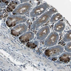 Immunohistochemical staining of human small intestine shows strong cytoplasmic positivity in glandular cells.